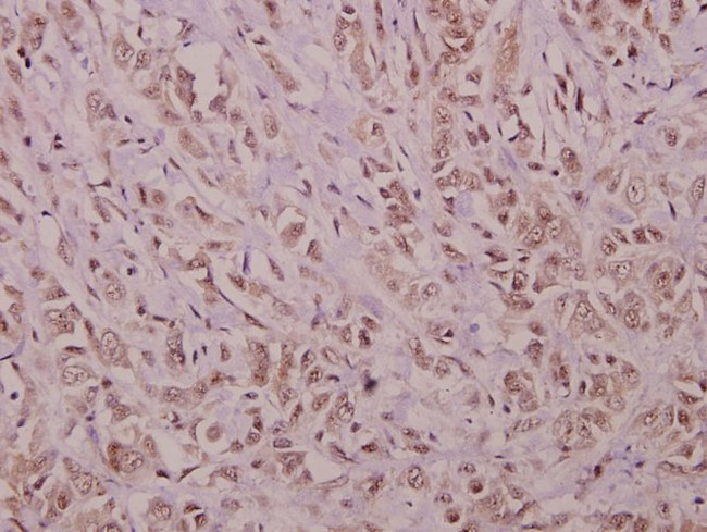 YAP1 Antibody in Immunohistochemistry (Paraffin) (IHC (P))