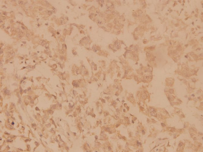 SHP2 Antibody in Immunohistochemistry (Paraffin) (IHC (P))