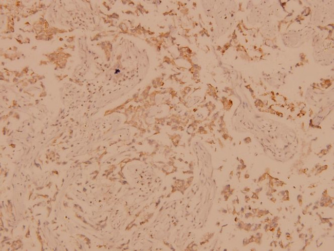 PLCG1 Antibody in Immunohistochemistry (Paraffin) (IHC (P))