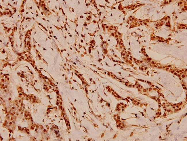 Cdc37 Antibody in Immunohistochemistry (Paraffin) (IHC (P))