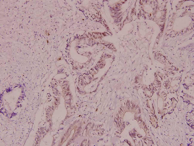 CRYAB Antibody in Immunohistochemistry (Paraffin) (IHC (P))