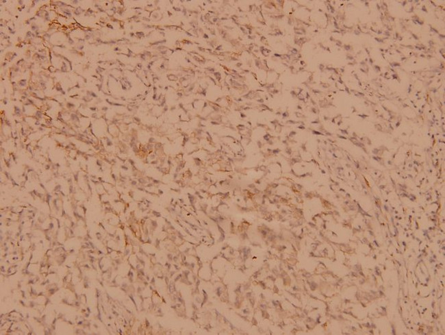 hnRNP C Antibody in Immunohistochemistry (Paraffin) (IHC (P))
