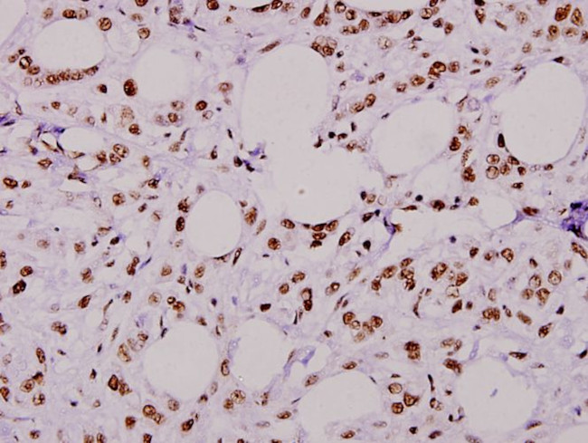 RSK1 Antibody in Immunohistochemistry (Paraffin) (IHC (P))