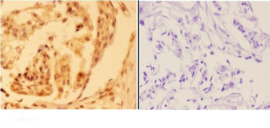 AMPK beta-1 Antibody in Immunohistochemistry (Paraffin) (IHC (P))