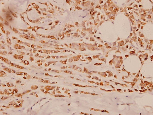 Cytokeratin 18 Antibody in Immunohistochemistry (Paraffin) (IHC (P))