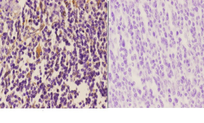 Vimentin Antibody in Immunohistochemistry (Paraffin) (IHC (P))