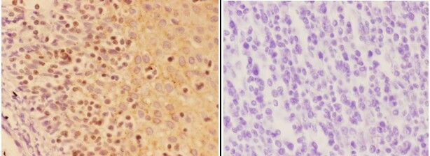 AIRE Antibody in Immunohistochemistry (Paraffin) (IHC (P))