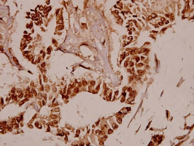 BAF53A Antibody in Immunohistochemistry (Paraffin) (IHC (P))