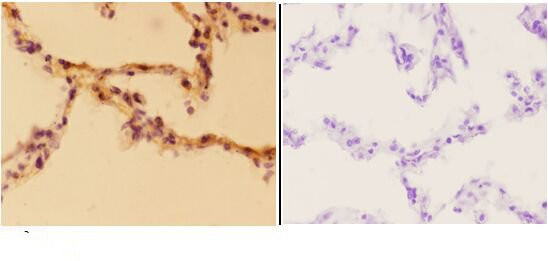 Aldolase A Antibody in Immunohistochemistry (Paraffin) (IHC (P))