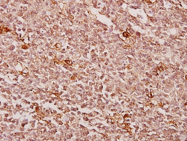 Creatine Kinase MM Antibody in Immunohistochemistry (Paraffin) (IHC (P))