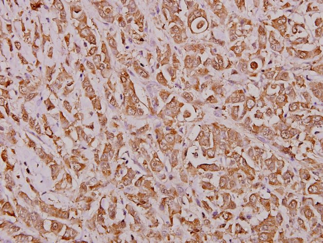 IRF2 Antibody in Immunohistochemistry (Paraffin) (IHC (P))