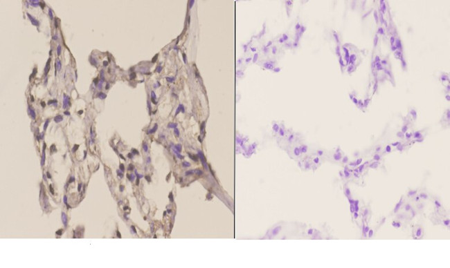 ATF1 Antibody in Immunohistochemistry (Paraffin) (IHC (P))
