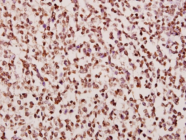 DGKA Antibody in Immunohistochemistry (Paraffin) (IHC (P))
