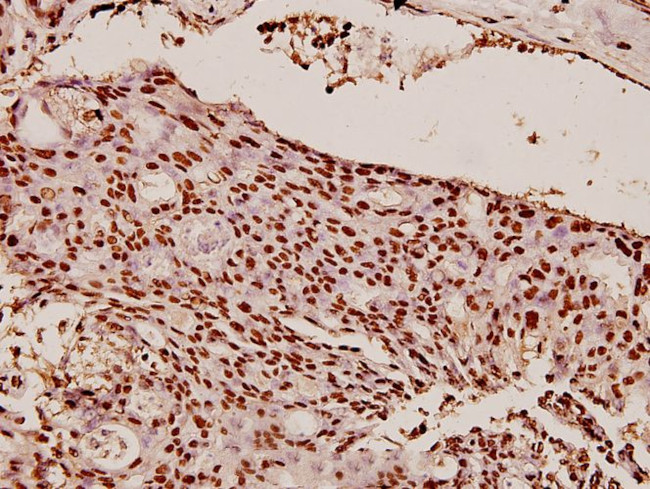 HP1 alpha Antibody in Immunohistochemistry (Paraffin) (IHC (P))