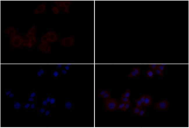 EphB4 Antibody in Immunocytochemistry (ICC/IF)