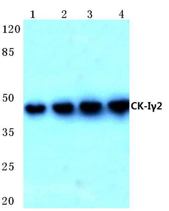 CK1 gamma-2 Antibody in Western Blot (WB)