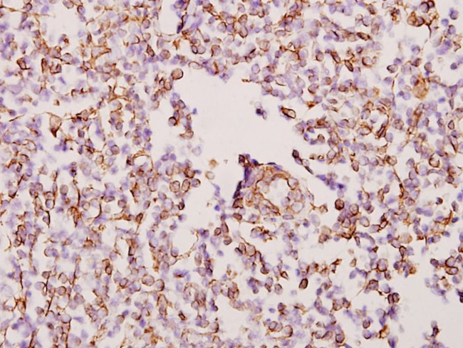 WTAP Antibody in Immunohistochemistry (Paraffin) (IHC (P))