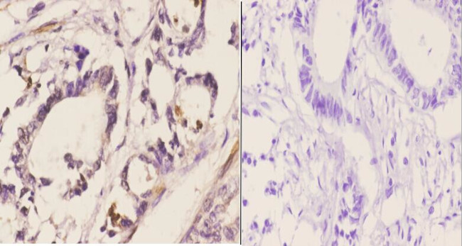 Cdc37 Antibody in Immunohistochemistry (Paraffin) (IHC (P))