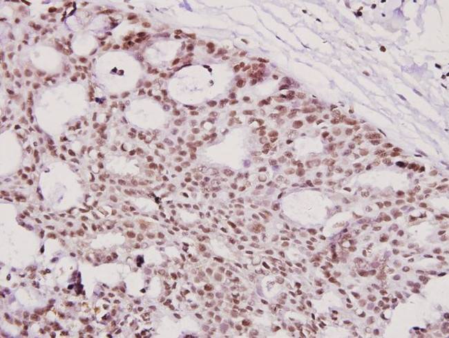ICAD Antibody in Immunohistochemistry (Paraffin) (IHC (P))