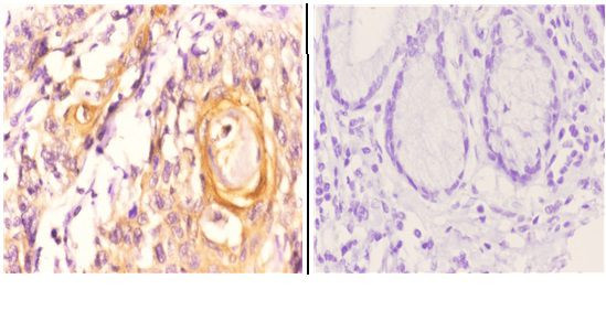 Maspin Antibody in Immunohistochemistry (Paraffin) (IHC (P))