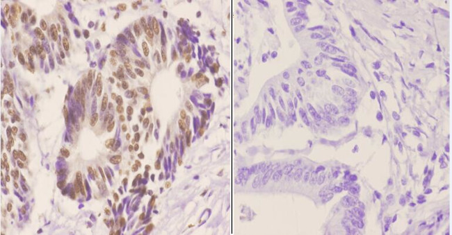 hnRNP C Antibody in Immunohistochemistry (Paraffin) (IHC (P))