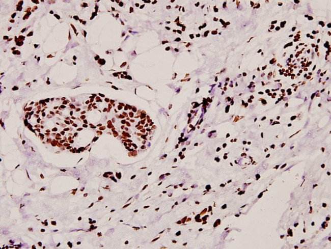 hnRNP A1 Antibody in Immunohistochemistry (Paraffin) (IHC (P))