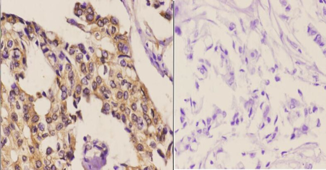 SnoN Antibody in Immunohistochemistry (Paraffin) (IHC (P))