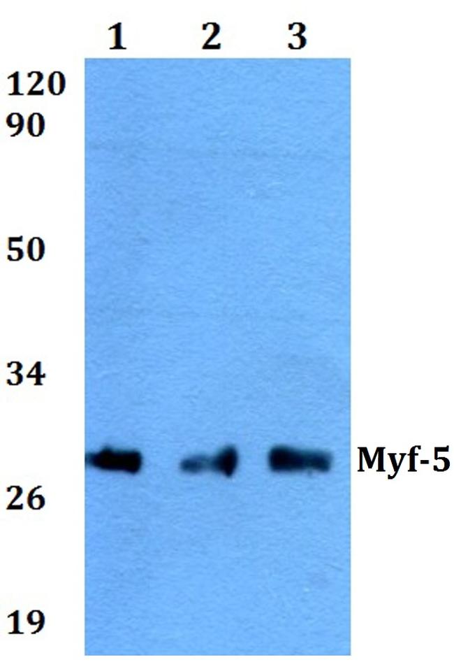 MYF5 Antibody in Western Blot (WB)