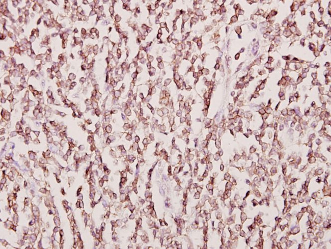 CKMT2 Antibody in Immunohistochemistry (Paraffin) (IHC (P))