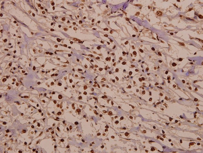 CDK2 Antibody in Immunohistochemistry (Paraffin) (IHC (P))