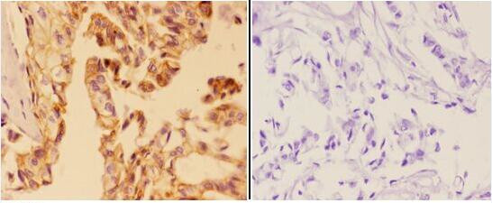 AMPK beta-1 Antibody in Immunohistochemistry (Paraffin) (IHC (P))