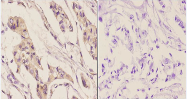 IGFBP3 Antibody in Immunohistochemistry (Paraffin) (IHC (P))