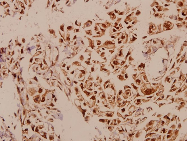 p73 Antibody in Immunohistochemistry (Paraffin) (IHC (P))