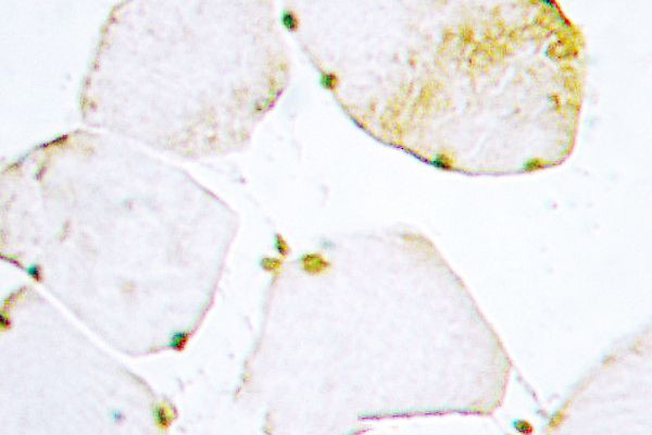 UNG Antibody in Immunohistochemistry (Paraffin) (IHC (P))