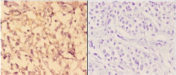 c-Abl Antibody in Immunohistochemistry (Paraffin) (IHC (P))
