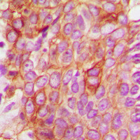 Bax Antibody in Immunohistochemistry (Paraffin) (IHC (P))