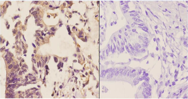 MGMT Antibody in Immunohistochemistry (Paraffin) (IHC (P))