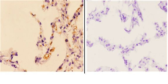 Granzyme H Antibody in Immunohistochemistry (Paraffin) (IHC (P))