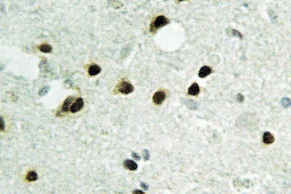 Histone H2B Antibody in Immunohistochemistry (Paraffin) (IHC (P))