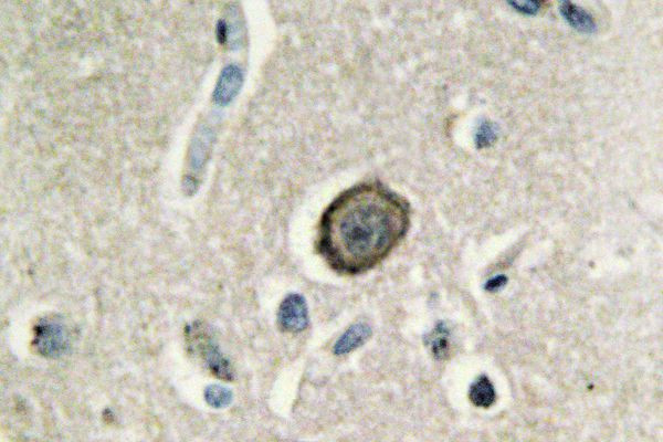 CDH8 Antibody in Immunohistochemistry (Paraffin) (IHC (P))