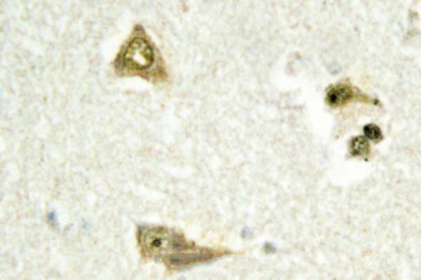 TSC22D1 Antibody in Immunohistochemistry (Paraffin) (IHC (P))