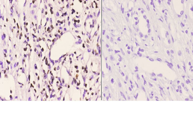 PMS2 Antibody in Immunohistochemistry (Paraffin) (IHC (P))