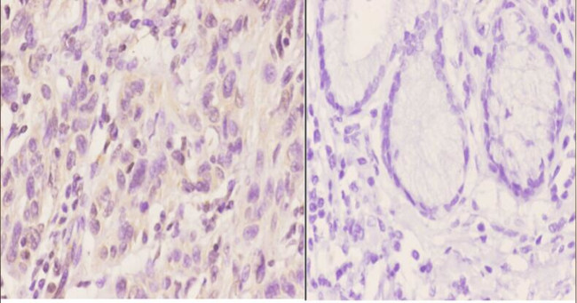 Ku80 Antibody in Immunohistochemistry (Paraffin) (IHC (P))