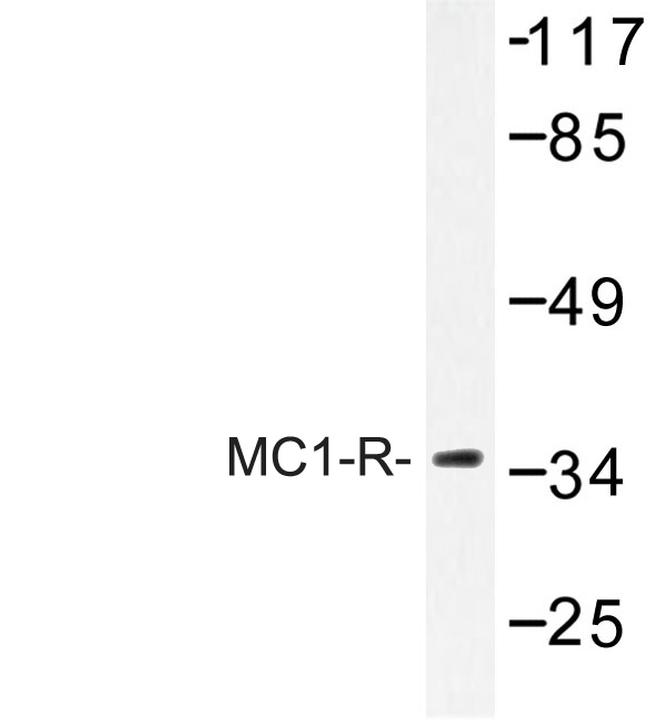 MC1R Antibody in Western Blot (WB)