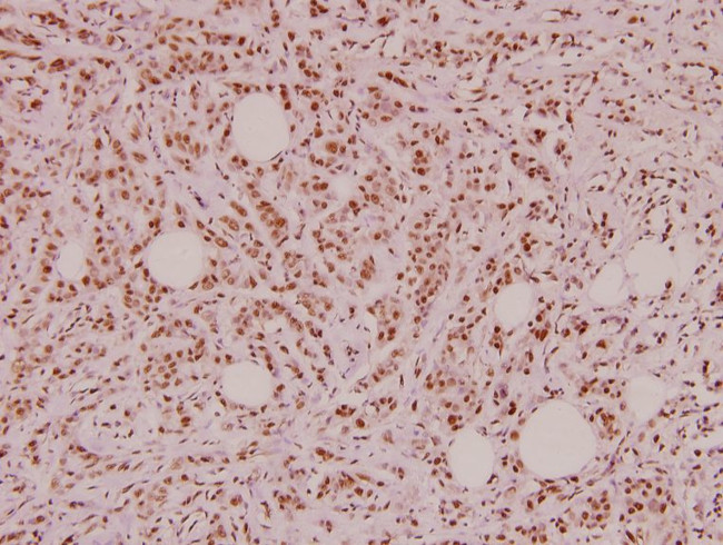 VIP Antibody in Immunohistochemistry (Paraffin) (IHC (P))