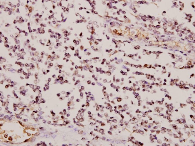 GCLM Antibody in Immunohistochemistry (Paraffin) (IHC (P))