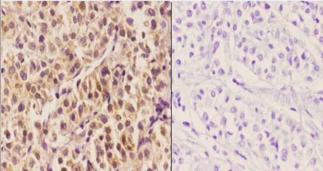 HNF4A Antibody in Immunohistochemistry (Paraffin) (IHC (P))