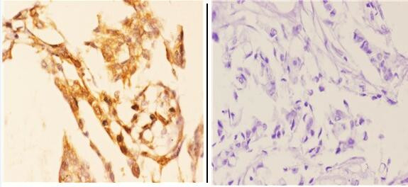 AKT1 Antibody in Immunohistochemistry (Paraffin) (IHC (P))