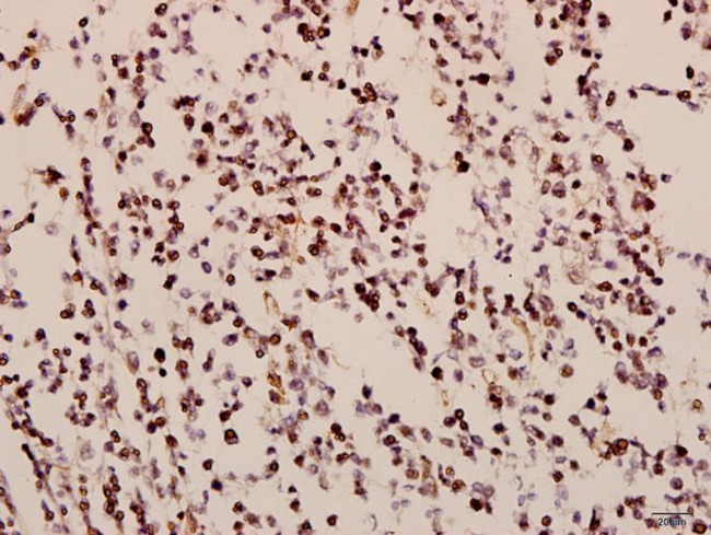 GNAZ Antibody in Immunohistochemistry (Paraffin) (IHC (P))