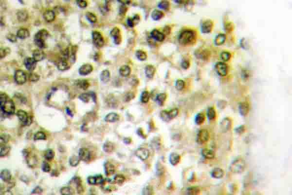 Histone H2B Antibody in Immunohistochemistry (Paraffin) (IHC (P))